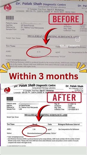This patient had been trying to conceive for 16 years and was diagnosed with low ovarian reserve