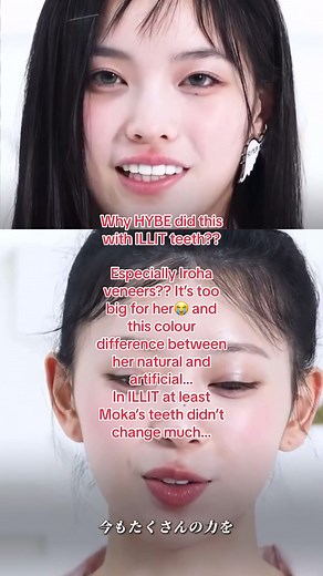 ILLIT IROHA’s theeth was fine, she didn’t need that veneers…@ILLIT | heeseung veneer