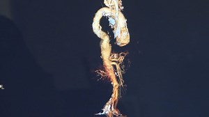 Health Spotlight: Aortic aneurysm warning signs