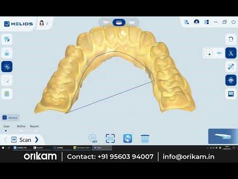Crystal-Clear Imaging – Superior full-arch scan precision, every time.
