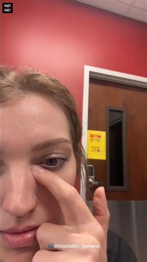 Why Does the Eye Make That Sound ?😱 #factinfact