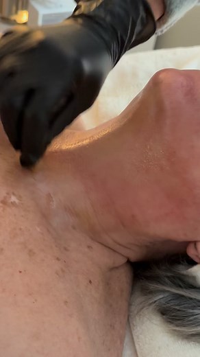 Knocking out dead skin cells to create new, fresh, more healthy skin is just too amazing sometimes!! ‍♀️‍♀️ @vipeel @lindsay.vipeel | Spa Angelique | Facebook