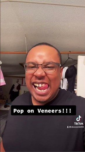 Yes! 👏 He's right! 👍 Now your teeth models included for free with your Pop On Veneers! 🎊