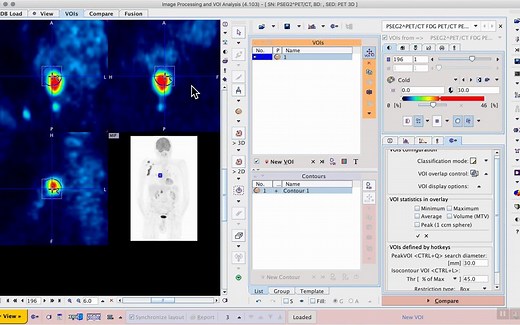 医学影像软件Pmod教程