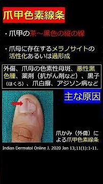 【爪の悪性黒色腫（メラノーマ）】爪のがんの特徴は？ #shorts
