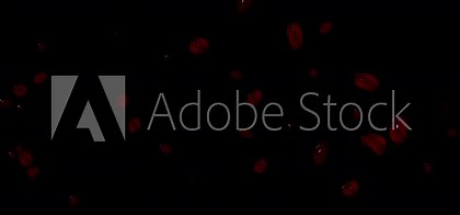 Blood Drops Dripping Down in Camera Screen Glass - Transparent Background [20sec 30fps Video]