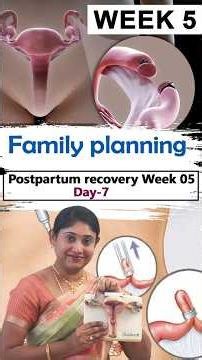 Permanent family planning after delivery | week 5 day 7 Dr. Savitha Ashok