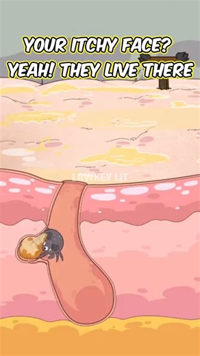 Your itchy face? Yeah! THEY live there😱