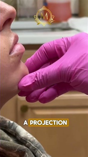 The best way to get a perfect profile