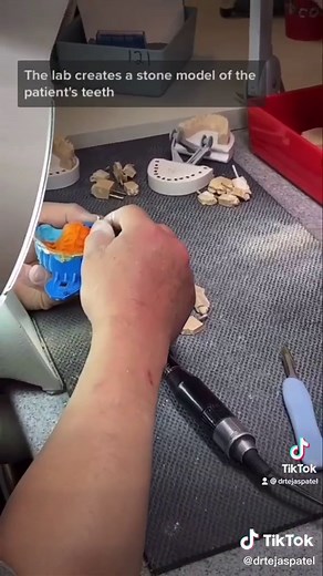 How Veneers Are Made: A Step-by-Step Guide