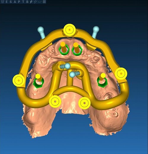 Real Guide - Upper Stackable Guide - Step 1