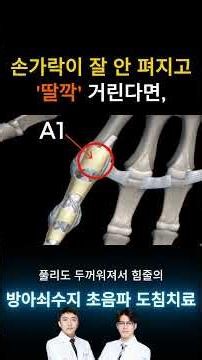 손가락이 잘 안 펴지고, '딸깍' 거린다면#방아쇠수지증후군 #손가락통증 #초음파도침치료 #부산한의원