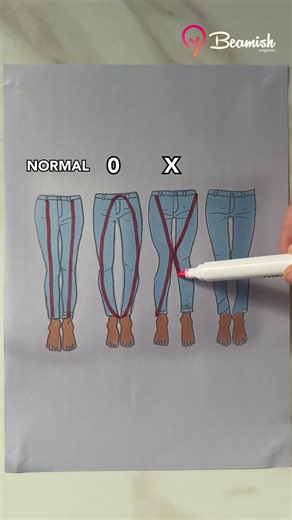Different Leg Shapes Explained 👖 #simple #leg #shapes #explained