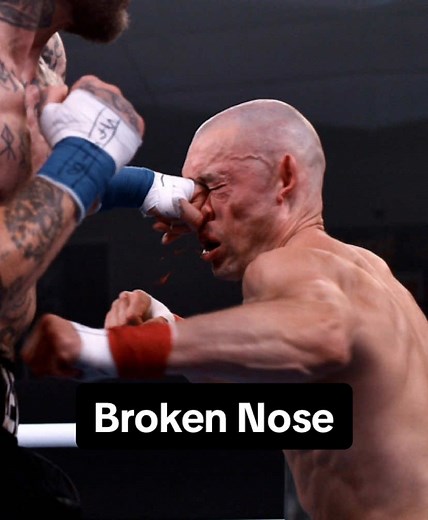 Brutal Broken Nose in Bare Knuckle Boxing