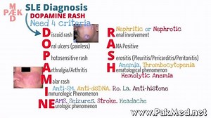 3.4K views · 75 reactions | Systemic Lupus Erythematosus (SLE) | PakMed - CME | Facebook