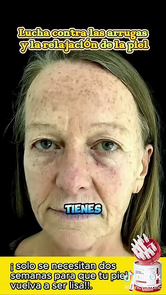 El secreto de la piel para mantener la juventud#149 #wrinkles #skins