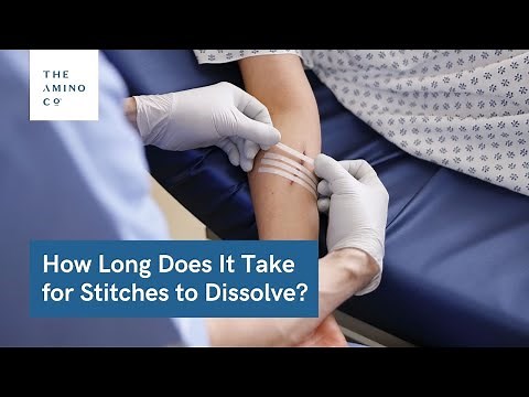 How Long Does It Take for Stitches to Dissolve? (With 5 Tips to Accelerate Healing)