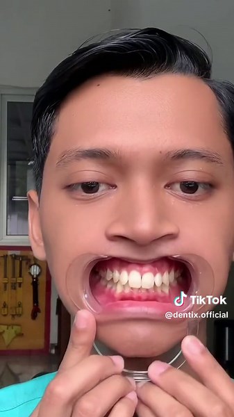 Trik Memutihkan Gigi dengan Dentix di Rumah