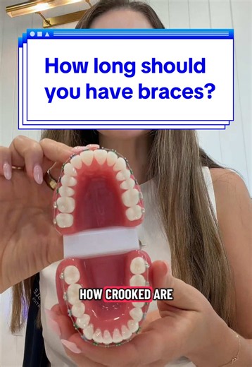 How long should you really have braces on to get your smile straight and perfect? Comment if you knew at least one of these factors that determine braces timing. 🦷🤔⏰ #smileisleorthodontics #braces #bracesoff #smiles #teeth