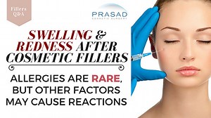 Swelling or too Much Restylane? The Doctor's Opinion
