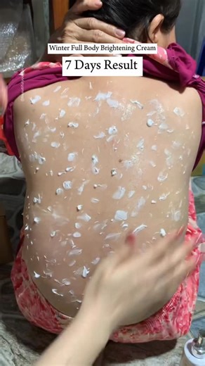 𝑩𝒆𝒂𝒖𝒕𝒊𝒇𝒖𝒍 𝒀𝒐𝒖 𝑻𝒊𝒑𝒔 on Instagram: "✨DIY Brightening Body Cream✨ light and dark body parts like under arms, knees, hand, feet neck😍 Natural ingredients to help your skin look fresh, smooth & nourished! 💛 I mixed: 🍋 Fresh lemon juice 💧 A little glycerin 🌿 Aloe vera gel 🥥 A bit of coconut oil 💊 (Optional) brightening capsules from Amazon Mix everything well and apply on hands, feet, neck, back, or any area that needs extra care. Use **twice a day** for visible improvement in a