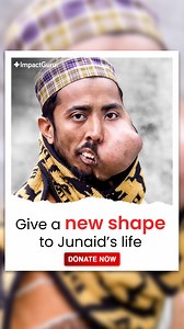 76K views · 1.6K reactions | A face deformity has been the reason of suffering in my life since my birth. I have known nothing but pain because of the growing tissues of my face and I am constantly teased and mocked by those around me. Please end my suffering. Donate for my costly surgery! - Junaid Donate Now : https://bit.ly/3HanbDF | Impact Guru | Facebook