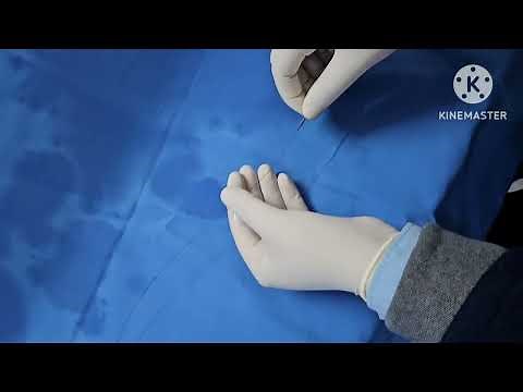 How to use a Thrombus Aspiration Catheter Device in Coronaries? Export / Thrombuster / Eliminate