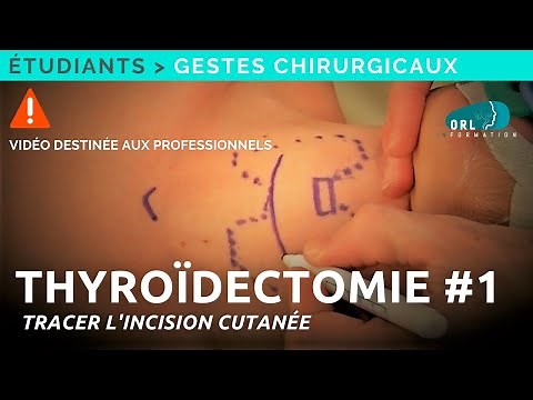 Comment réaliser une thyroïdectomie | #1 Tracer l'incision cutanée | Formation chirurgie ORL