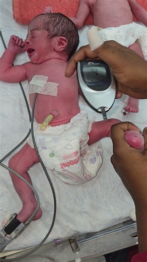 👶👶 Twins RBS Check 😱#shorts #newbornbaby #nicucare #trendingreels #viralvideo #rbs #glucose #twins