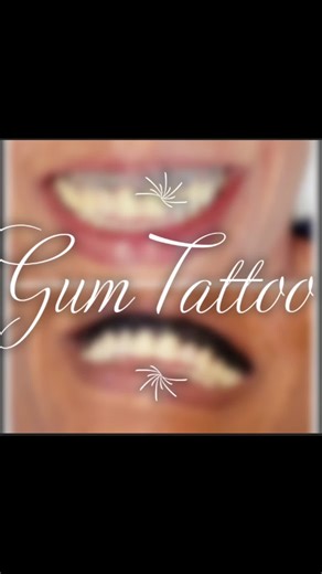 #gumtattoo✨ is traditional way enhancing the beauty of teeth and boost dental health using natural products. The benefit of tattooing the gum? - It has a cosmetic enhancement to frame the teeth. - The most important health benifit is that it helps to stop the bleeding of the gum, helps with sensitive gum tissue, It kills bacteria and fill out the gaps in between teeth. The basic definition of gums is ‘the tissue that surrounds your teeth’. In technical language they are called ‘the gingiva’. The