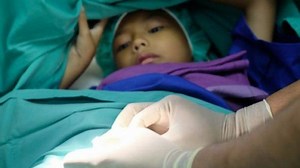 Inilah Beberapa Macam Sunat Modern dengan Metode yang Lebih Baik, Berikut Penjelasan Dokter - TribunHealth.com