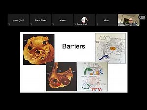 Atypical Atrial Flutter: The Mapping Dilemma - Dr. Khaled Awad MD