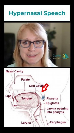 Do You Have Hypernasal Speech?