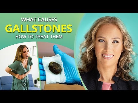 What Causes Gallstones & How to Treat Them | Dr. J9 Live