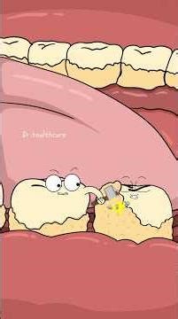 How Plaque Turns Into Tartar (And Why Flossing Matters)?