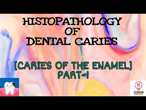 HISTOPATHOLOGY OF DENTAL CARIES - CARIES IN THE ENAMEL PART-1
