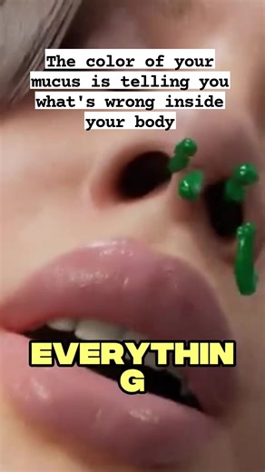174K views · 1.8K reactions | The color of your mucus is secretly telling you what's wrong inside your body. Courtesy: Wellness Lab #mucus #health #mucuscolor #awareness #healthandwellness #Wellness #science | Mommy Che | Facebook