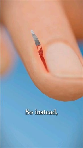 How to Properly Remove Hangnails 😱 #shorts