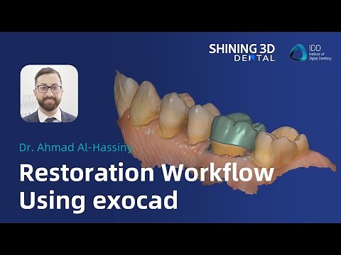Restoration workflow using exocad
