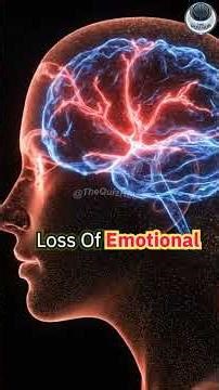 Stress, Anxiety, Depression — What’s the Difference? #stress #depression #anxiety
