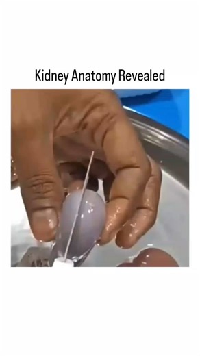 Science on Instagram: "Ever wondered what the inside of a kidney looks like? This video shows a dissection, providing a clear view of the kidney's internal anatomy, including the outer cortex and inner medulla. A great visual for biology and anatomy students or anyone curious about organs . . . #kidney #anatomy #dissection #biology #science #internalstructure #organs #education #sciencevideo #learn #viral #explore #trending"