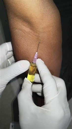 intravenous injection #ivinjection #bscnursing #nursing
