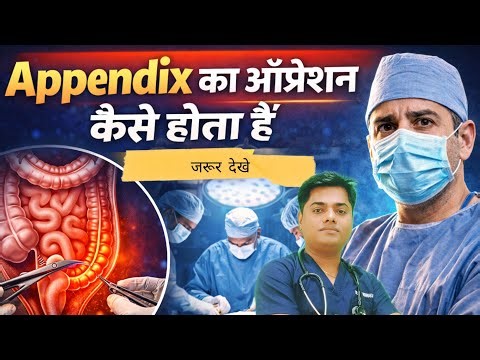 अपेंडिक्स का ऑपरेशन कैसे होता है ? || Appendix Surgery पूरी जानकारी आसान भाषा में .