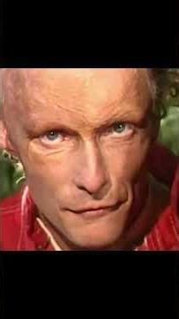 The Unburned Man Niki Lauda
