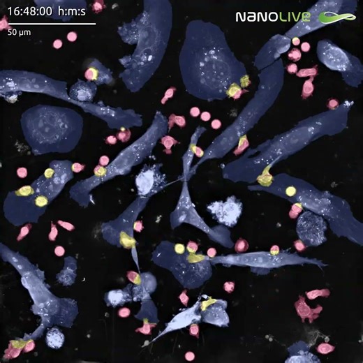 🧬𝗛𝗼𝘄 𝘁𝗼 𝗲𝘃𝗮𝗹𝘂𝗮𝘁𝗲 𝘁𝗵𝗲 𝗰𝘆𝘁𝗼𝘁𝗼𝘅𝗶𝗰𝗶𝘁𝘆 𝗼𝗳 𝘆𝗼𝘂𝗿 𝗖𝗔𝗥-𝗧 𝗰𝗲𝗹𝗹 𝗮𝘂𝘁𝗼𝗺𝗮𝘁𝗶𝗰𝗮𝗹𝗹𝘆?