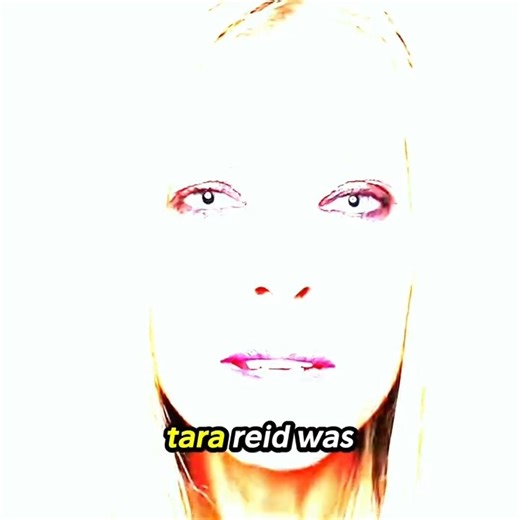 Celebrity Memorial on Instagram: "CELEBS WHO FADED FROM THE SPOTLIGHT AFTER PLASTIC SURGERY #PlasticSurgery #HollywoodFame #CelebrityDownfall #PopCulture #ThenAndNow"