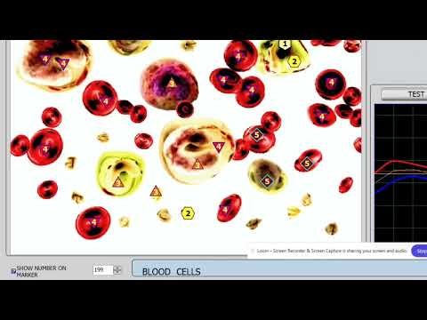 What is Bioresonance? Frequency Healing: The Healing of the Future ✨