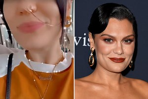 Jessie J's health woes continue as she undergoes 24-hour test for acid reflux