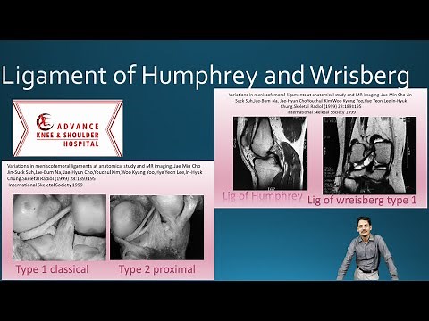 Meniscofemoral ligament (ligament of humphrey and ligament of wrisberg)