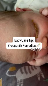 Has your newborn shown signs of a blocked tear duct (eye goopy & puffy) or an eye infection? This can be common after birth while baby is a newborn .. ask your doctor about breastmilk remedies as an option 👀🍼 with my first baby, my little one started to develop a blocked tear duct & my doctor actually suggested using breastmilk as a first line of treatment. I was amazed to see it clear up within a couple days of using breastmilk eyedrops! 🤩🤍 ✅ Like and Follow @_from.mom.to.mom for more mom t